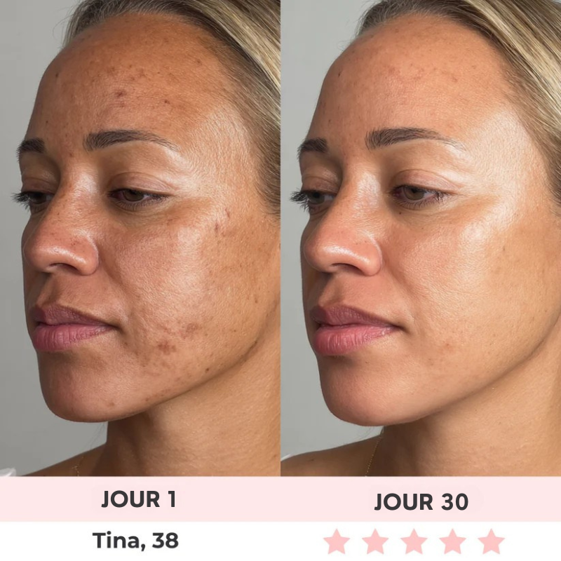 Sculpteur Facial LED Brenoro 7-en-1